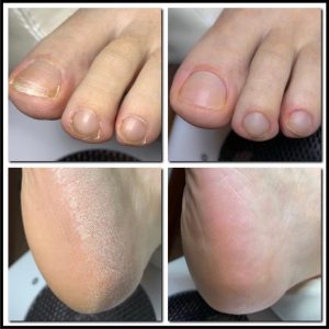 Corso Dry Pedicure e Soak Off - immagine 1